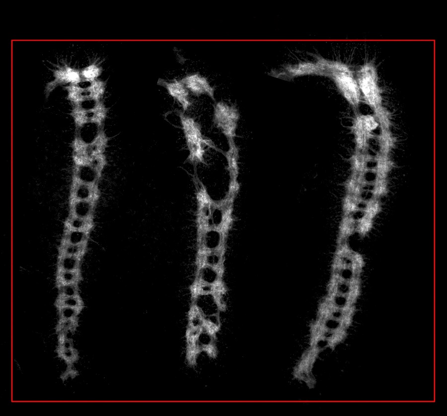 This image shows an example of defects in the development of the embryonic central nervous system in stored eggs that lacked the Fmr1 gene. 