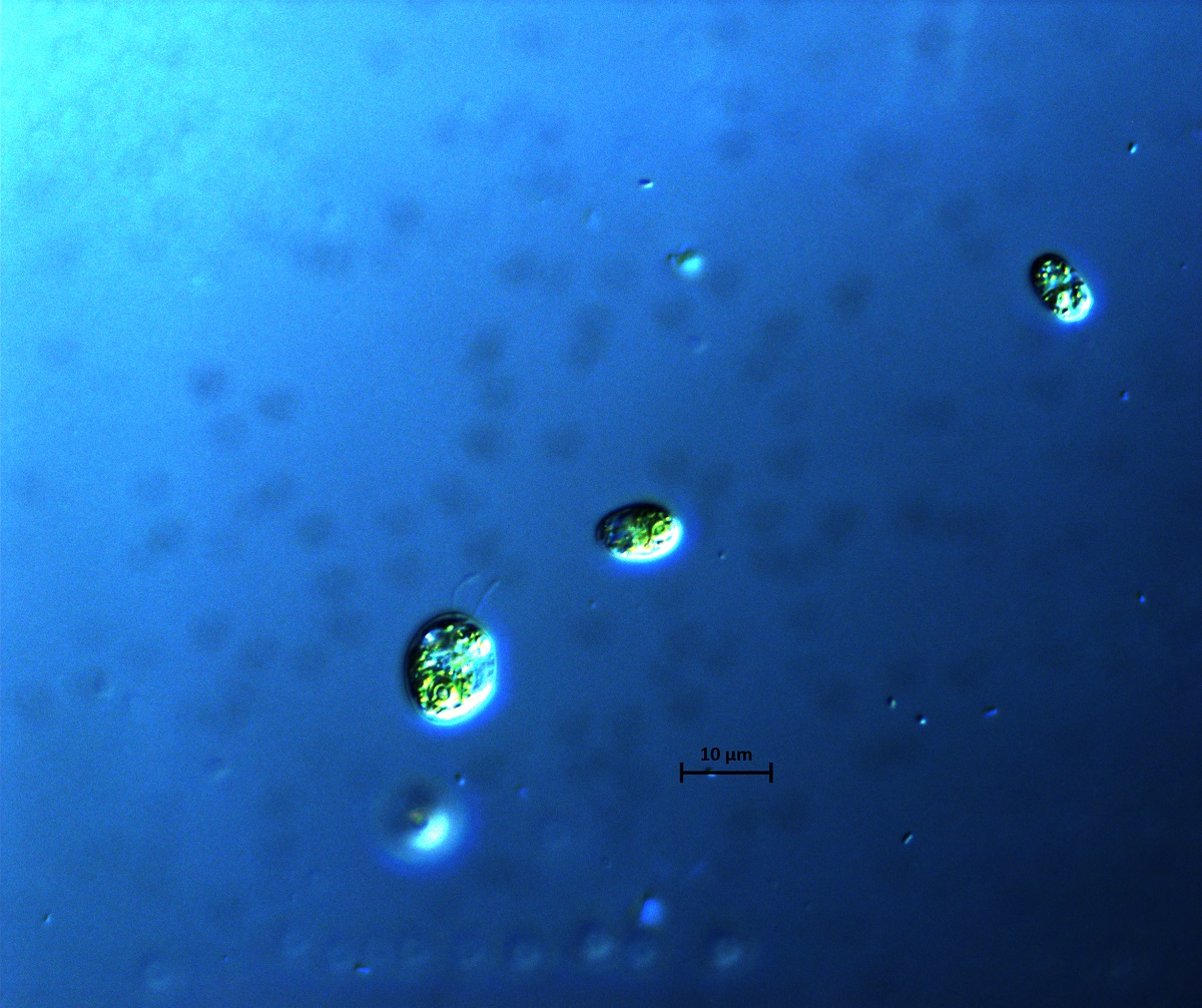 Chlamydomonas photo courtesy of Natasha and Natalie Rothhausen of the University of Dusseldorf.