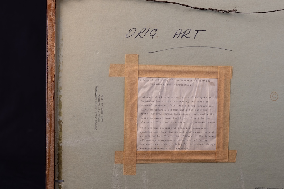 Back of Ramsey Placenta Drawing