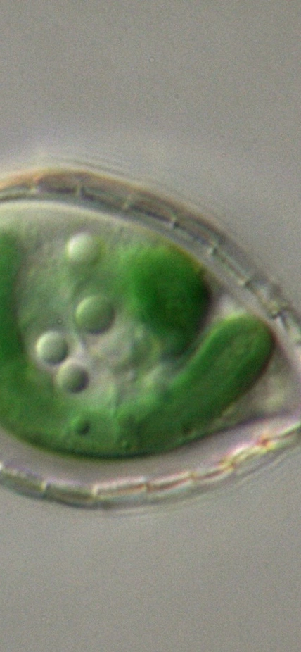 This micrograph of the single-celled Paulinella shows the photosynthetic “machinery” in green. Photo courtesy of Eva Nowack.
