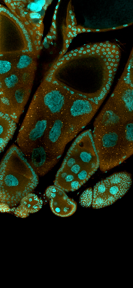 Cells under a microscope courtesy of Ethan Greenblatt
