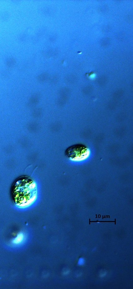 Chlamydomonas photo courtesy of Natasha and Natalie Rothhausen of the University of Dusseldorf.