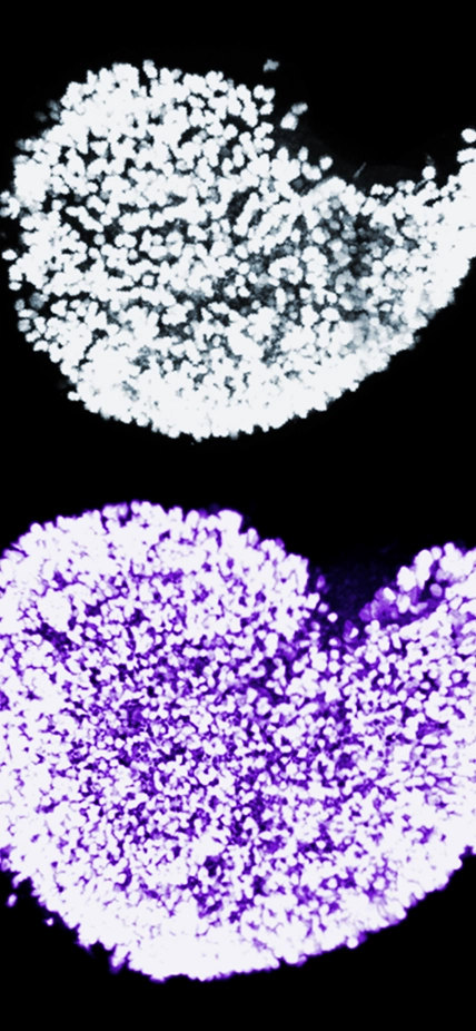 The dramatic increase in immature egg cells in newborn mice when Fetal Oocyte Attrition is prevented, courtesy Marla Tharp and Navid Marvi.