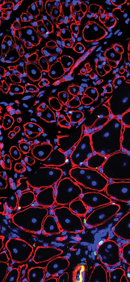 Composite image: GDNF repairs aged muscle stem cells 