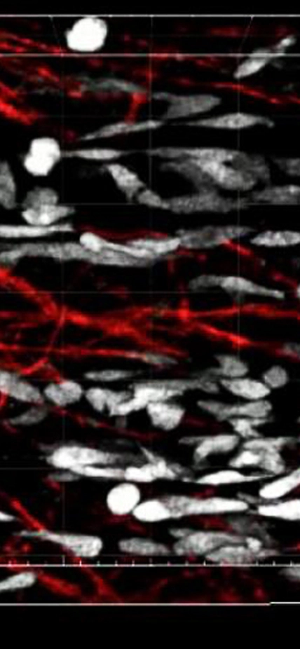 ‘Ghost Fibers’ Left Behind by Injured Muscle Cells Guide Stem Cells Into Position for Regeneration