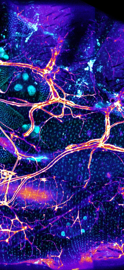 Microscope image of fly gut