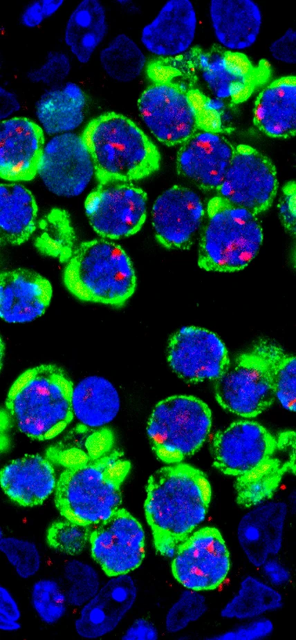 Transposons (green), flood germ cells (DNA-blue)—the precursor cells of sperm in the male mouse.