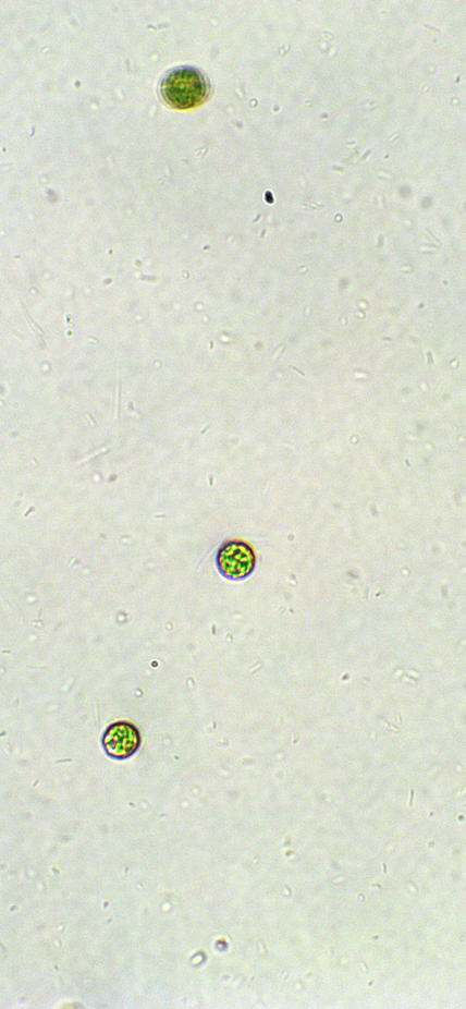 Chlamydomonas under the microscope