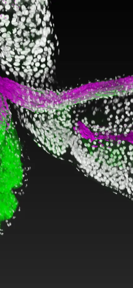 Lactobacillus, a beneficial bacterial species (magenta), attaches to specific regions (green) of the fruit fly gastrointestinal tract (white). Image is courtesy of Ren Dodge/Carnegie Science.