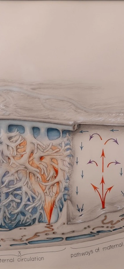 Ramsey Placenta Drawing by Crosby