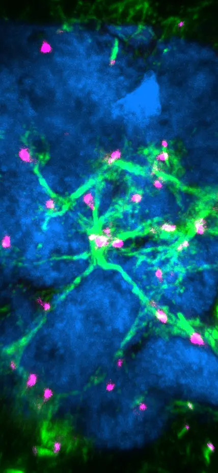 This image shows the blue nuclei of a cluster of cells called a germline cyst in the ovary of an African clawed frog. One of these sister cells will develop into an egg and the others will become nurse cells. Miniscule scaffolds connect the cells and are visible here in green. Centrioles—the organizing centers from which these networking materials grow—are marked in magenta. Courtesy: Asya Davidian, Postdoctoral Associate // Spradling Lab // Biosphere Sciences & Engineering
