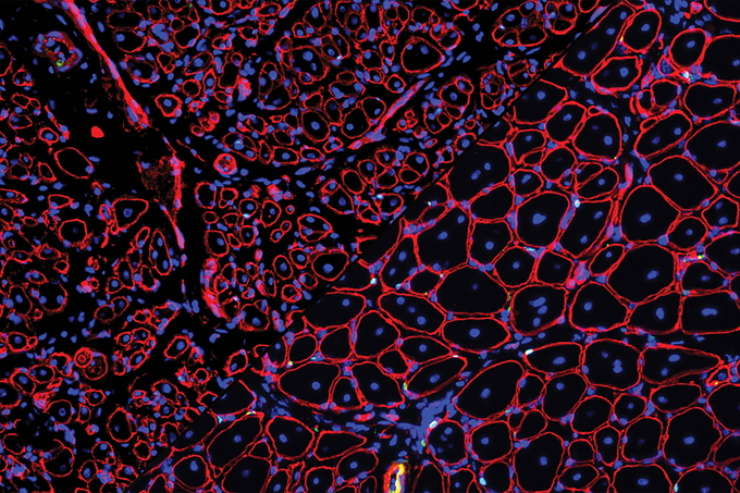 Composite image: GDNF repairs aged muscle stem cells