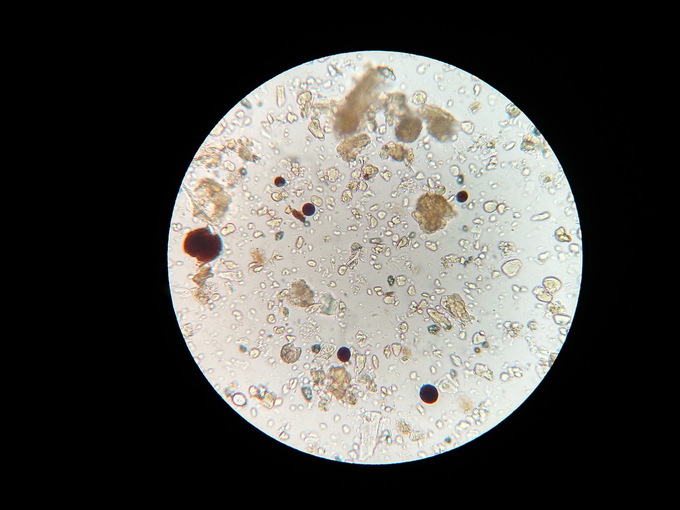 soil-microbes-g7785d995d_1280.jpg