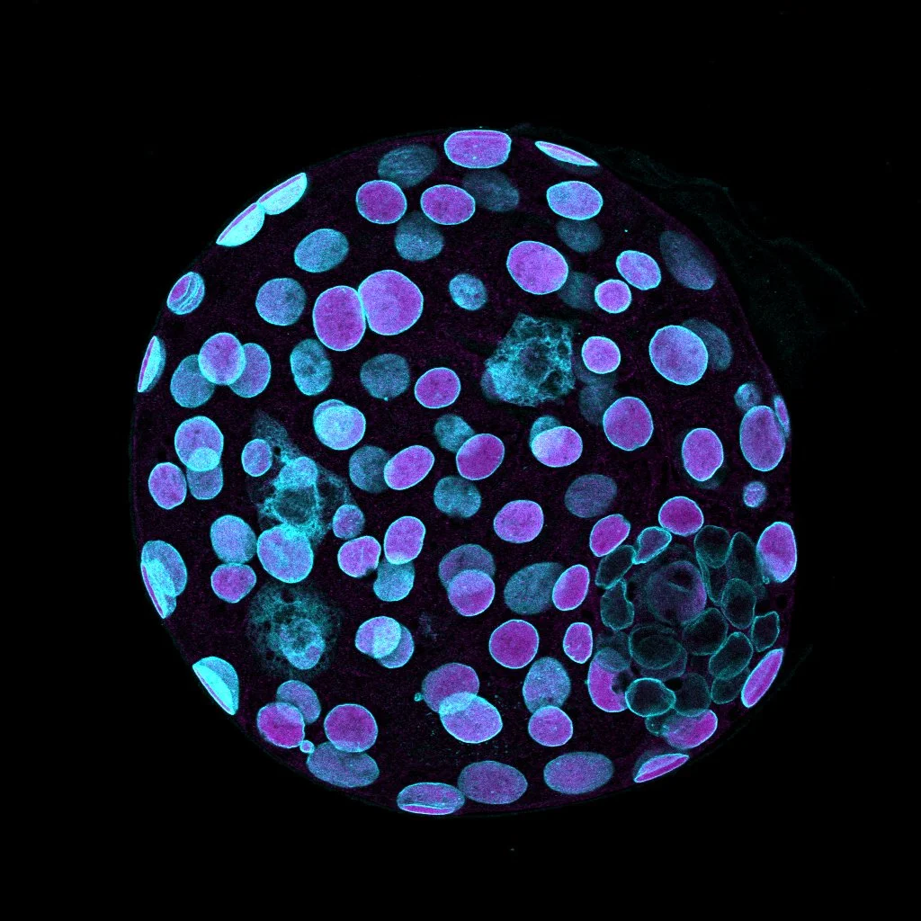 2022 | Embryonic Light