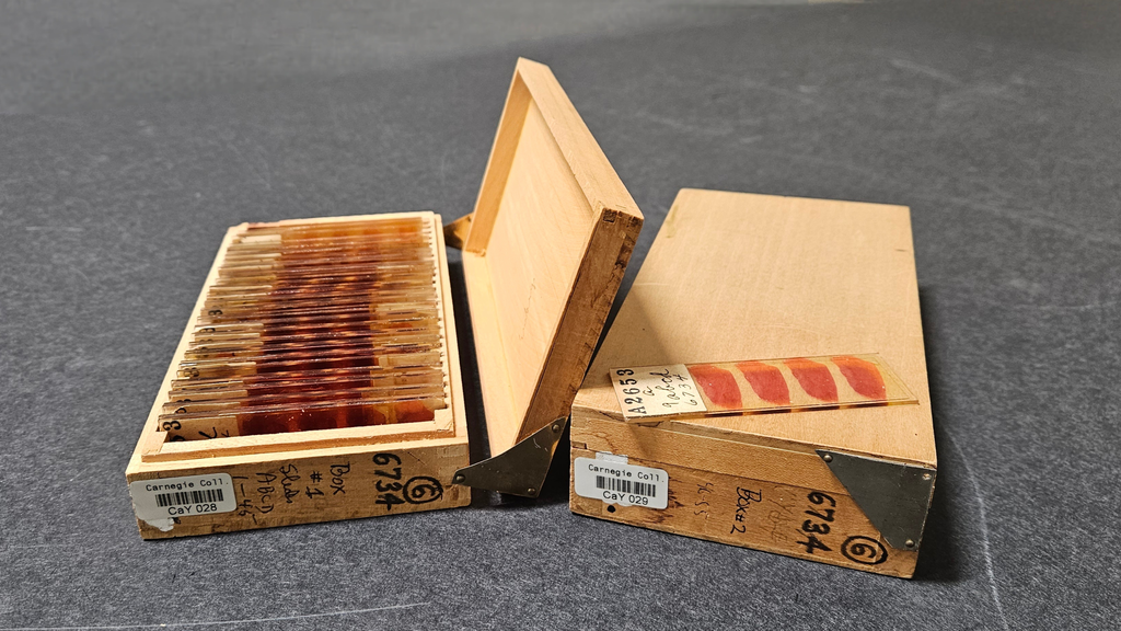 The sectioned Yale embryo with its storage boxes