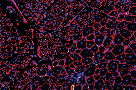 Composite image: GDNF repairs aged muscle stem cells