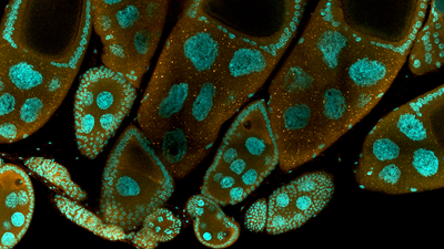 Cells under a microscope courtesy of Ethan Greenblatt