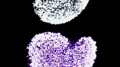 The dramatic increase in immature egg cells in newborn mice when Fetal Oocyte Attrition is prevented, courtesy Marla Tharp and Navid Marvi.