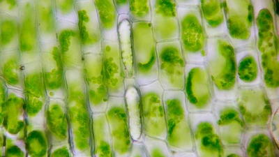 Plant cells under a microscope