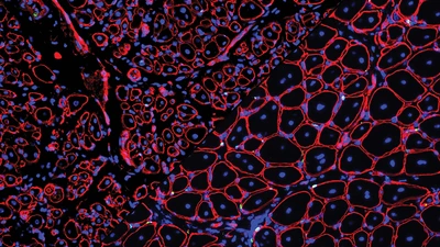 Composite image: GDNF repairs aged muscle stem cells 