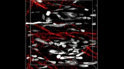 ‘Ghost Fibers’ Left Behind by Injured Muscle Cells Guide Stem Cells Into Position for Regeneration