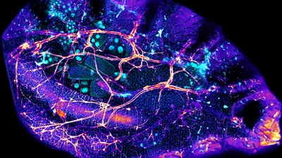 Microscope image of fly gut