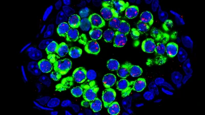 Transposons (green), flood germ cells (DNA-blue)—the precursor cells of sperm in the male mouse.