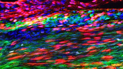 Image of the Patellar tendon 30 days after injury