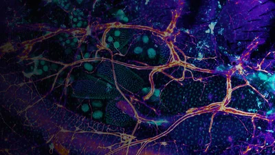 Fly gut microscopy 