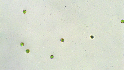 Chlamydomonas under the microscope