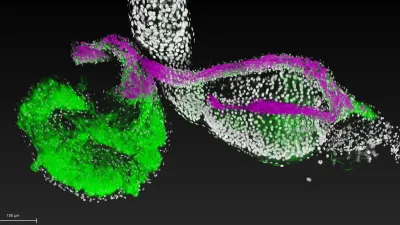  Lactobacillus, a beneficial bacterial species (magenta), attaches to specific regions (green) of the fruit fly gastrointestinal tract (white). Image is courtesy of Ren Dodge/Carnegie Science.