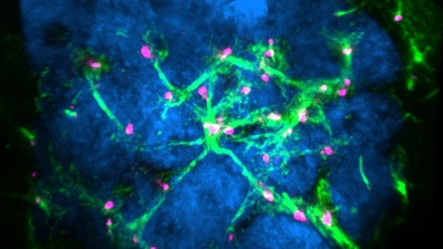 Sister cell interactions in a frog ovary cyst