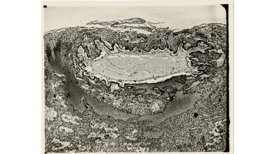 Photographed section of the Yale embryo