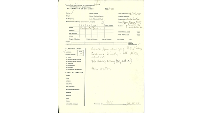 Yale embryo's Carnegie Collection form