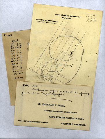 Franklin Mall’s manuscript notes for human embryo Specimen #417 in the Carnegie Collection of Human Embryos.