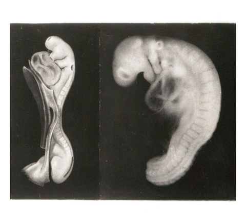 Embryos.