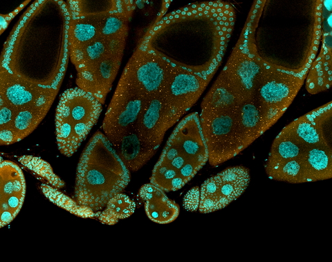 Cells under a microscope courtesy of Ethan Greenblatt