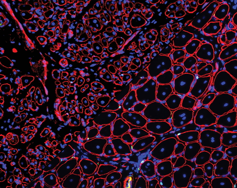 Composite image: GDNF repairs aged muscle stem cells 