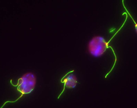 The aquatic, single-celled alga Chlamydomonas propels itself through the water with flagella, shown in green. The cells are stained with fluorescent dye. Work from a team including Carnegie’s Wenqiang Yang and Arthur Grossman, in collaboration with Matt Posewitz at the Colorado School of Mines, homes in on the biochemical pathways underlying the special flexibility of Chlamydomonas in responding to zero- and low-oxygen conditions. 