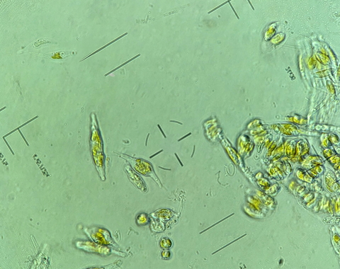 Phaeodactylum tricornutum under the microscope in Carnegie Staff Scientist Adrien Burlacot’s lab. He and Stanford University’s Ellen Yeh used CRISPR to identify the genes that keeps these highly successful organisms photosynthetically efficient in fluctuating light conditions. 