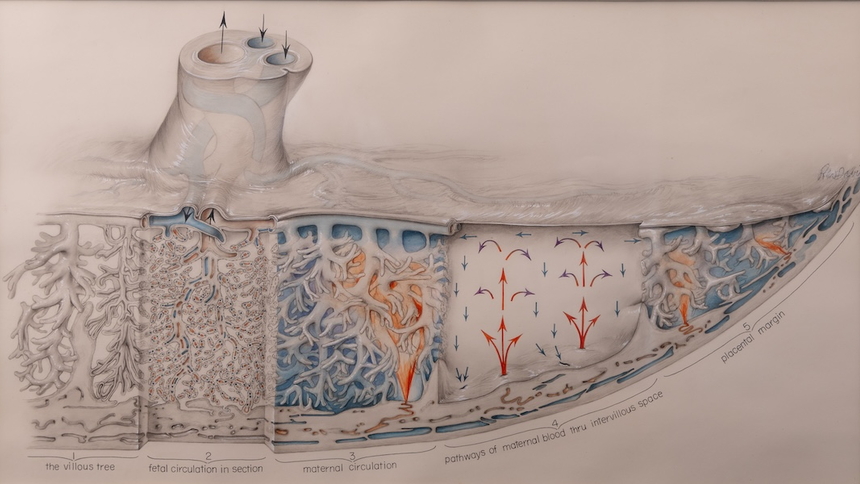 Ramsey Placenta Drawing by Crosby