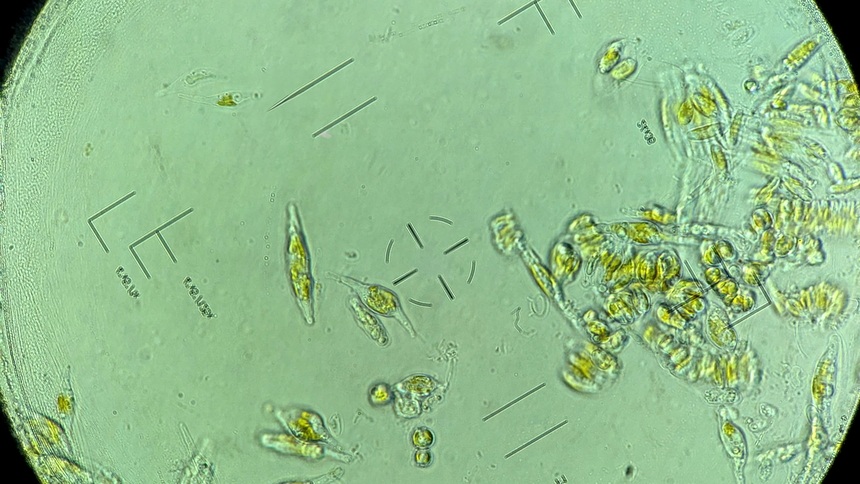 Phaeodactylum tricornutum under the microscope in Carnegie Staff Scientist Adrien Burlacot’s lab. He and Stanford University’s Ellen Yeh used CRISPR to identify the genes that keeps these highly successful organisms photosynthetically efficient in fluctuating light conditions. 