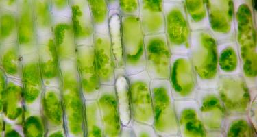 Plant cells under a microscope