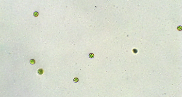 Chlamydomonas under the microscope