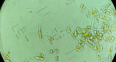 Phaeodactylum tricornutum under the microscope in Carnegie Staff Scientist Adrien Burlacot’s lab. He and Stanford University’s Ellen Yeh used CRISPR to identify the genes that keeps these highly successful organisms photosynthetically efficient in fluctuating light conditions. 