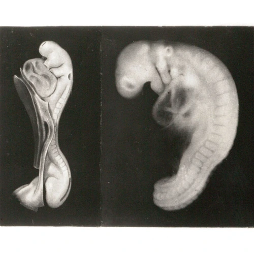 Embryos.
