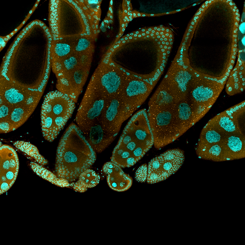 Cells under a microscope courtesy of Ethan Greenblatt