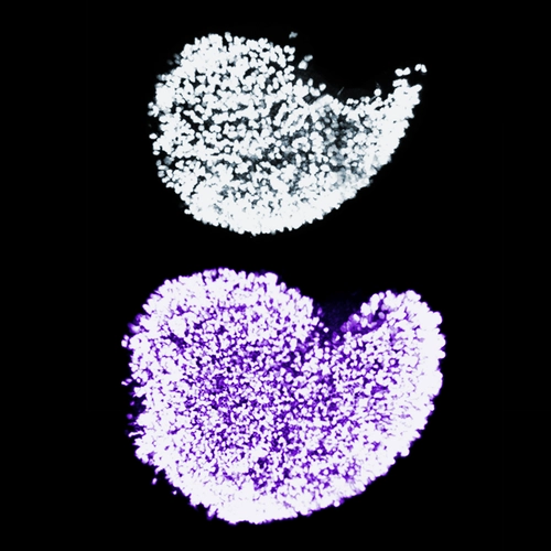 The dramatic increase in immature egg cells in newborn mice when Fetal Oocyte Attrition is prevented, courtesy Marla Tharp and Navid Marvi.