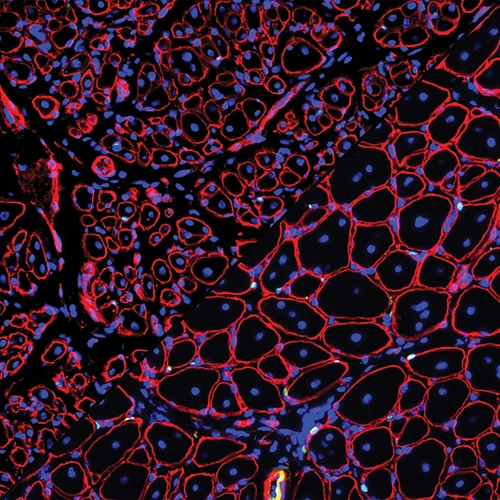 Composite image: GDNF repairs aged muscle stem cells 