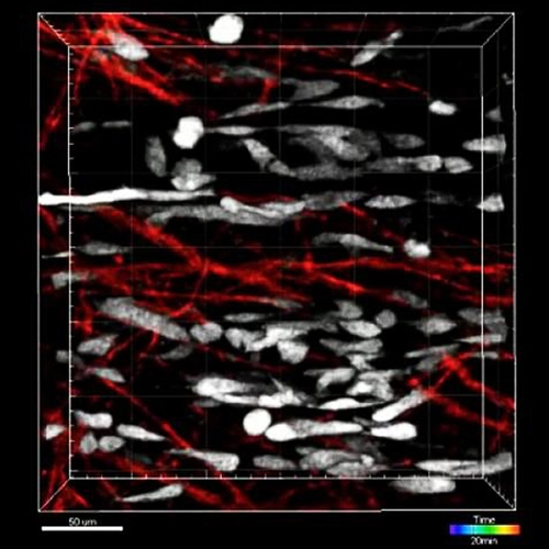 ‘Ghost Fibers’ Left Behind by Injured Muscle Cells Guide Stem Cells Into Position for Regeneration